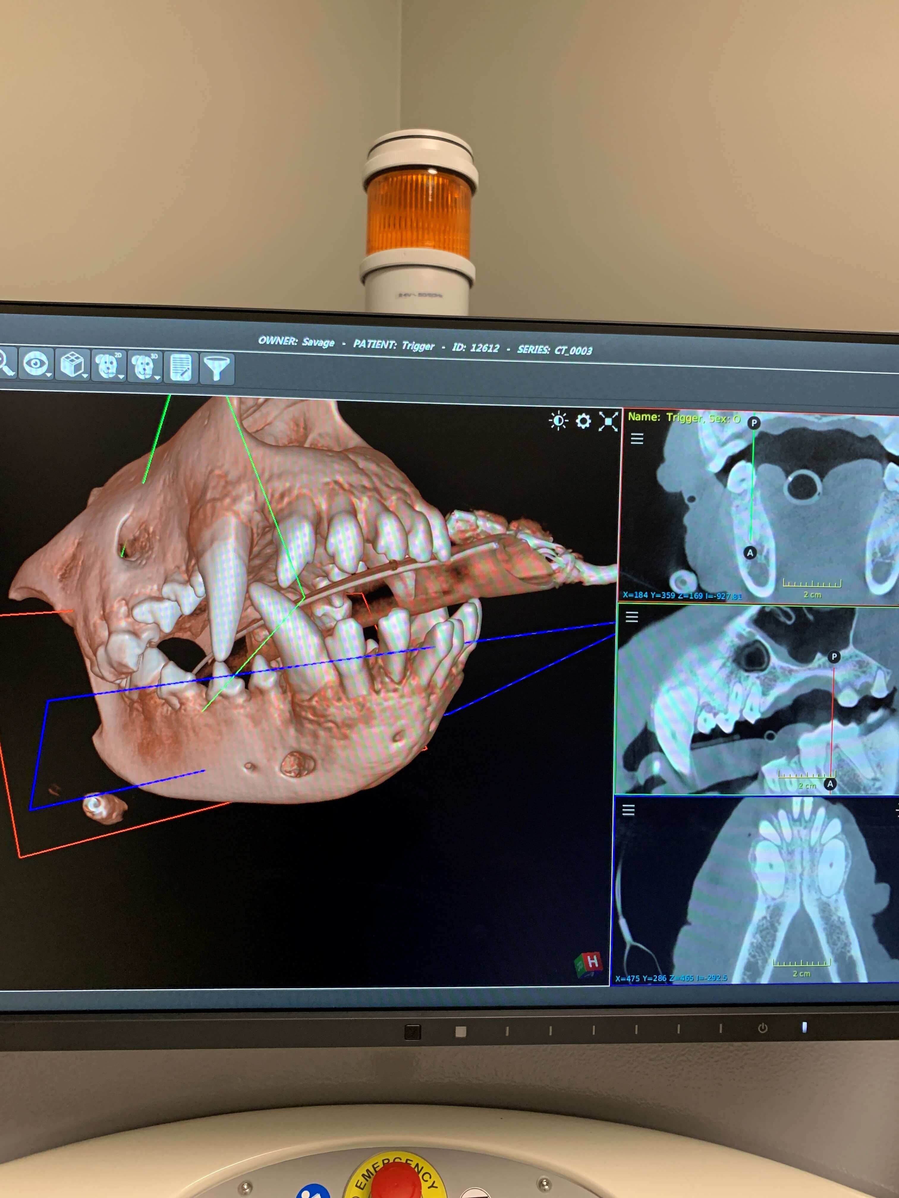 Dental CT image 1